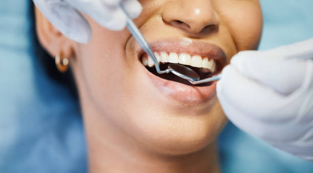 Best Emergency Root Canal Treatment in Greenville, DE